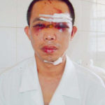 Hà Nội: Một thầy giáo bị đánh hội đồng